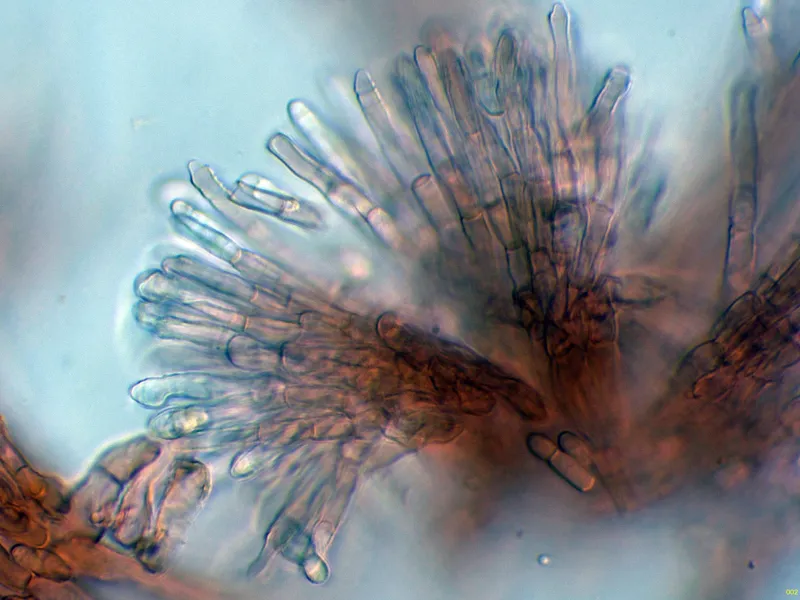 Annellodochium ramulisporum 10 - Hifas conidiógenas-002
